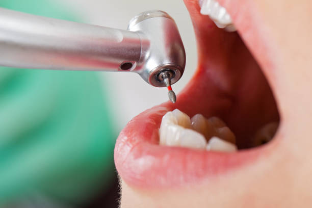 Best Emergency Gum Treatment in Falls Church, VA